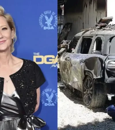 Actress Anne Heche suffers serious burns after hitting a house in Los Angeles