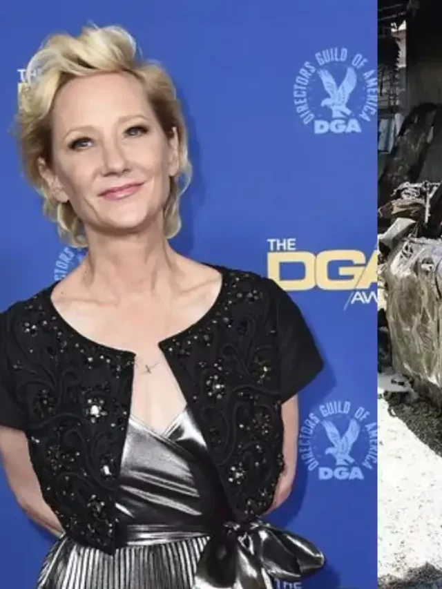 Actress Anne Heche suffers serious burns after hitting a house in Los Angeles